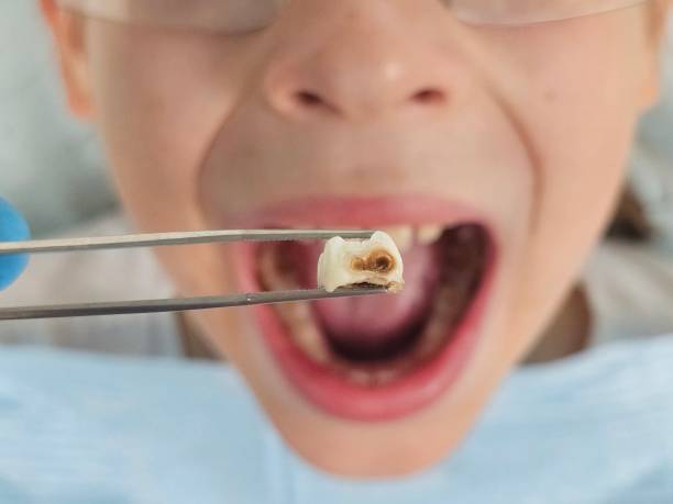 Best Tooth Pain Emergency Relief  in Experiment, GA